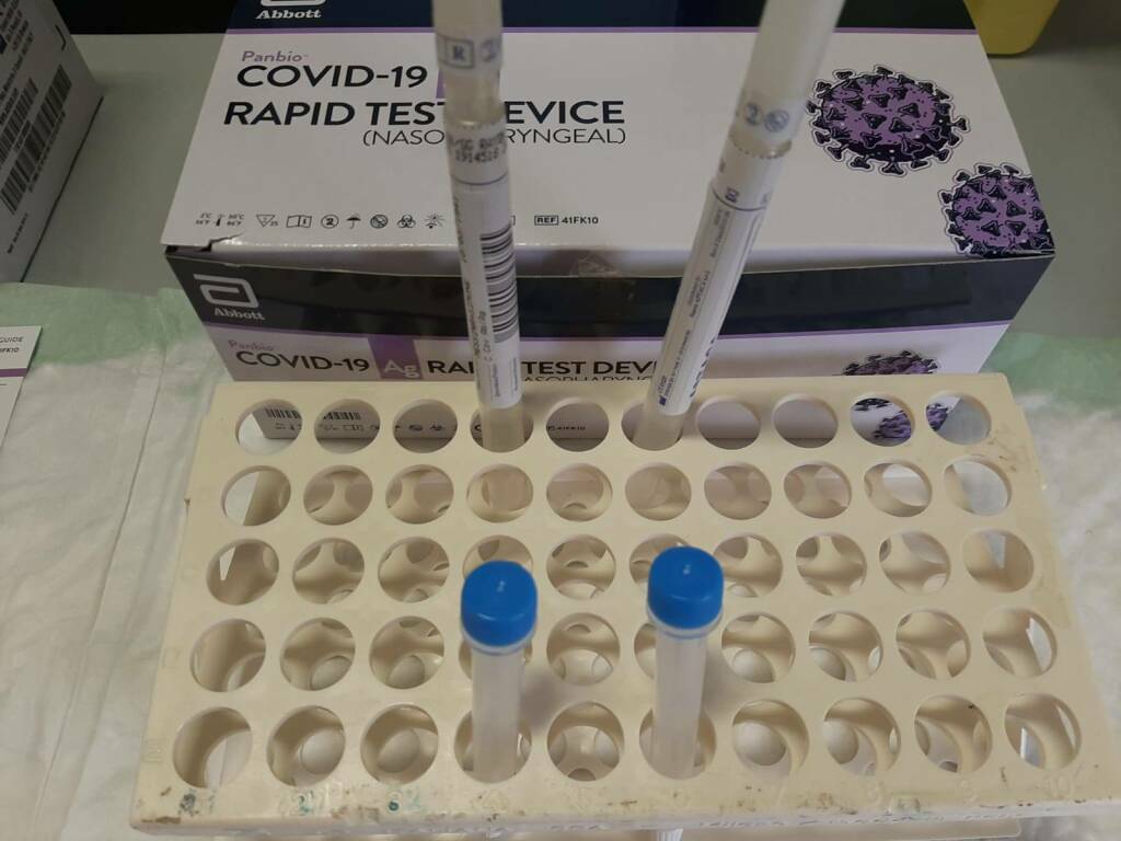 coronavirus tamponi